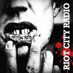 Riot City Radio – Spitting Teeth Review (2026)